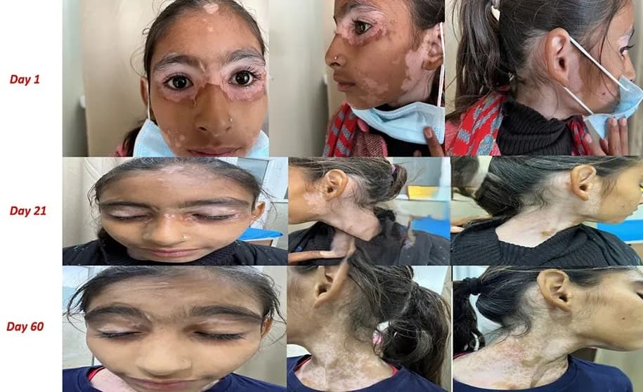 Dermatology treatment 3