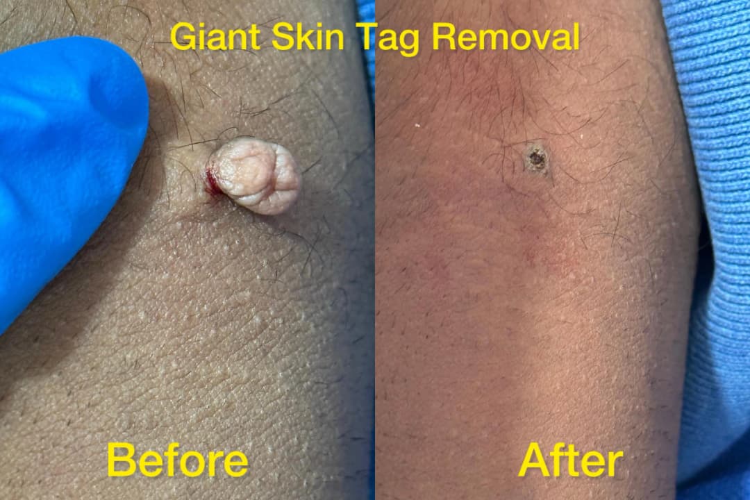 Dermatology treatment 8